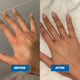 Before and after comparison of a hand with visible skin condition on a gray background.