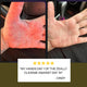 Hand before and after using Zeally Herbs Intestinal Parasite Cleanse with text overlay and star rating.